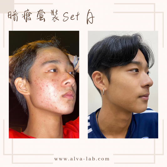 小瓶套裝！SET A (期間限定）